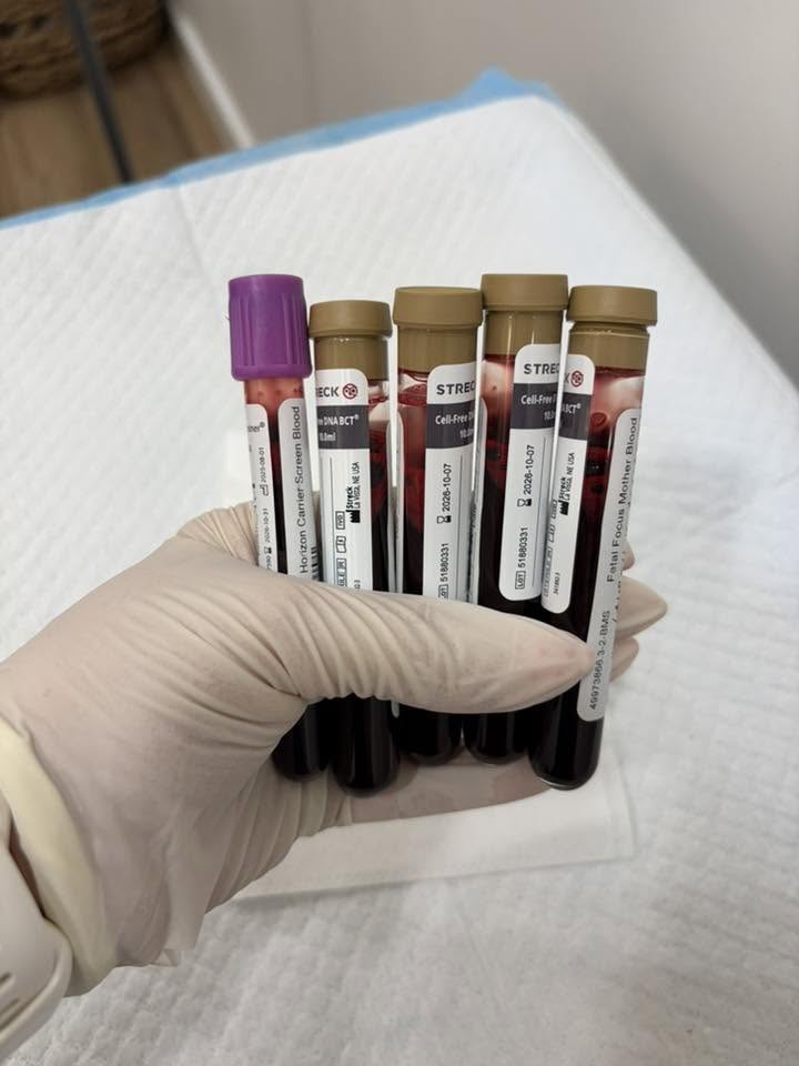 Gloved hand holding labeled blood collection tubes for lab testing